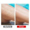SilkErase –  Painless Hair Remover